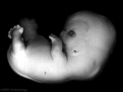 Day 20 Embryo